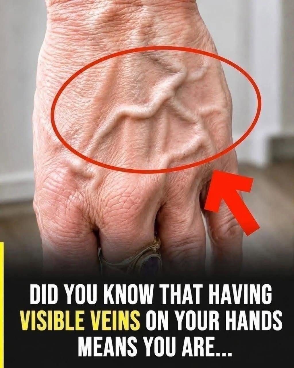 Study Biology Heat Can Make Veins More Visible Temperature can influence how prominent superficial blood vessels appear. Study Anatomy When the body is warm, blood vessels near the skin can become more noticeable as the body regulates its temperature. That’s one reason someone may notice that the veins on their hands look more prominent after: A hot shower Exercise Spending time outdoors in hot weather Physical labor Again, temporary visibility isn’t necessarily a sign of disease. 5. Genetics Play a Role Some people simply have more prominent superficial veins than others. Book Workouts The thickness of your skin, distribution of body fat, vein structure and other inherited characteristics all influence how visible your veins are. Two people of the same age and body weight can therefore have completely different-looking hands. One may have barely visible veins, while the other may have veins that are clearly outlined. Neither appearance necessarily tells you who is healthier.